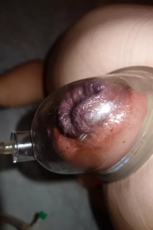 Mommy's purple fuck pig shithole pumped to prodigious proportions by jonmja