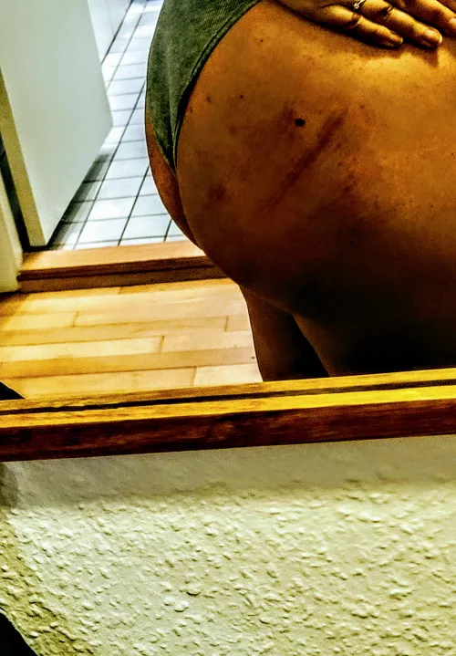 More bruises on my ass🤤 yes please 🥵 by frkmbuh