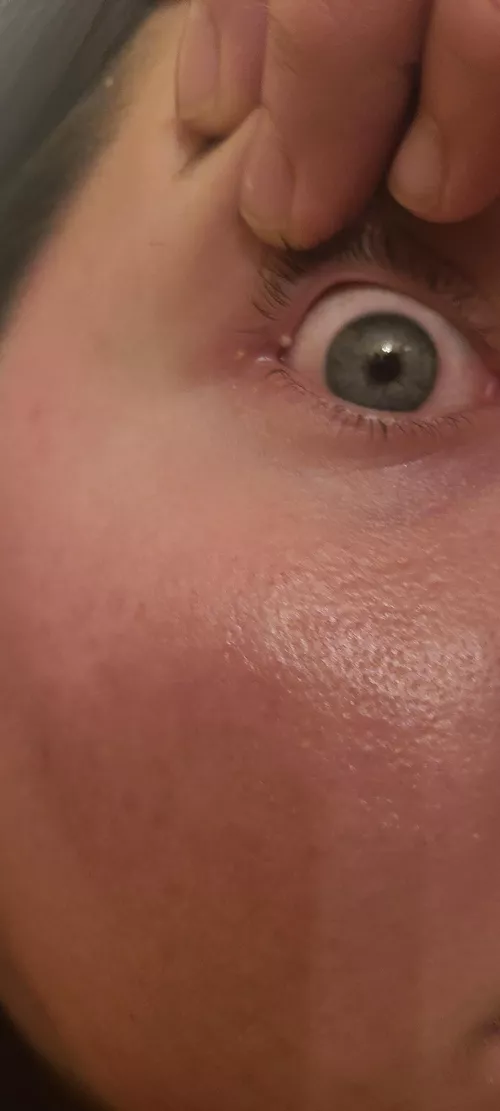 Most painful thing to ever happen to me by Theredroman