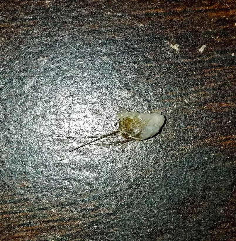 My 16 year old son sent me a photo of his belly button treasure. I’m sad I didn’t get to see the removal and that he didn’t take better photos! posted by BillieReuben