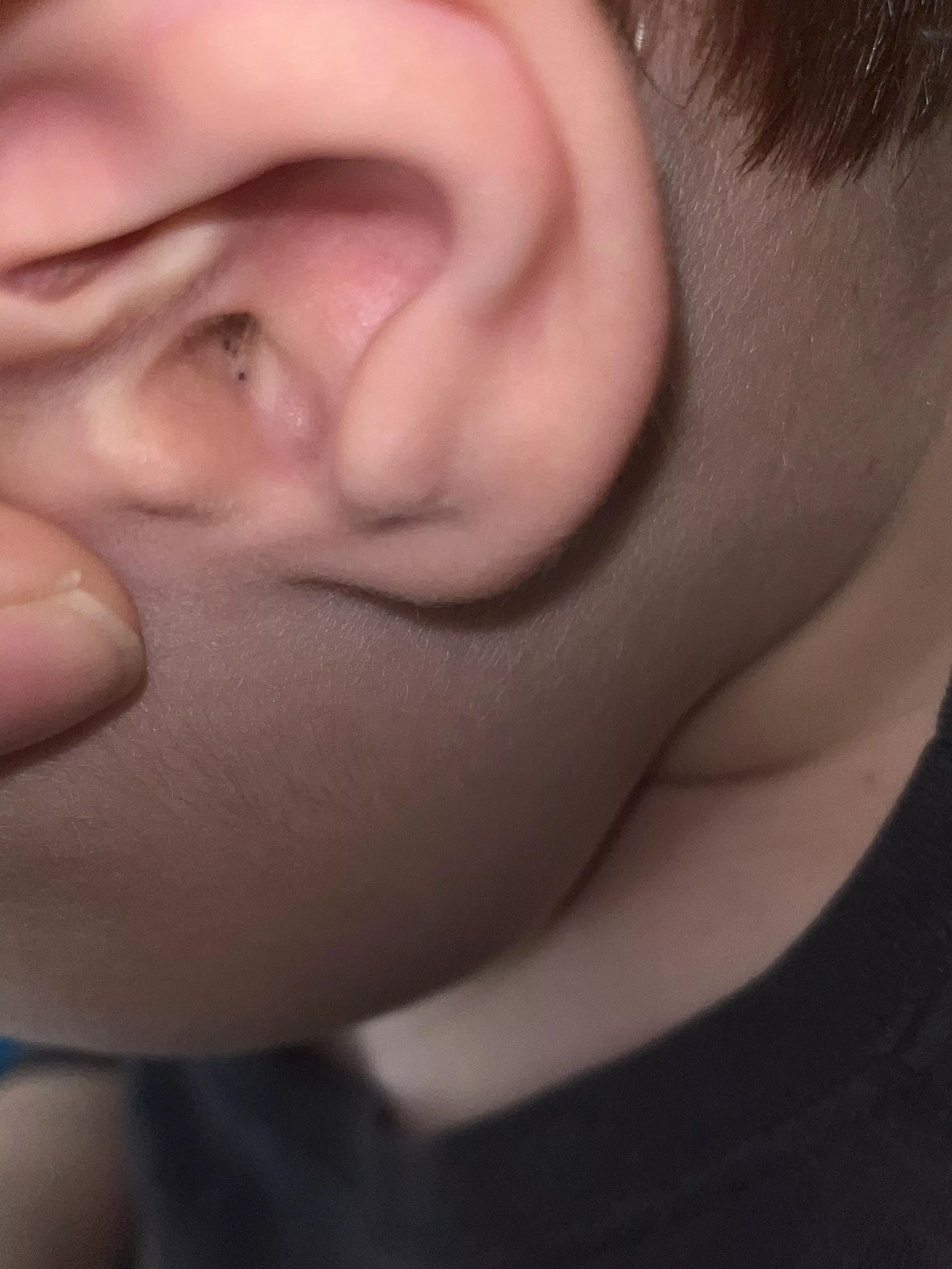 My 5 year old’s left ear is taunting me… posted by MrsToneZone