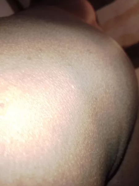 My ass by nursse1981