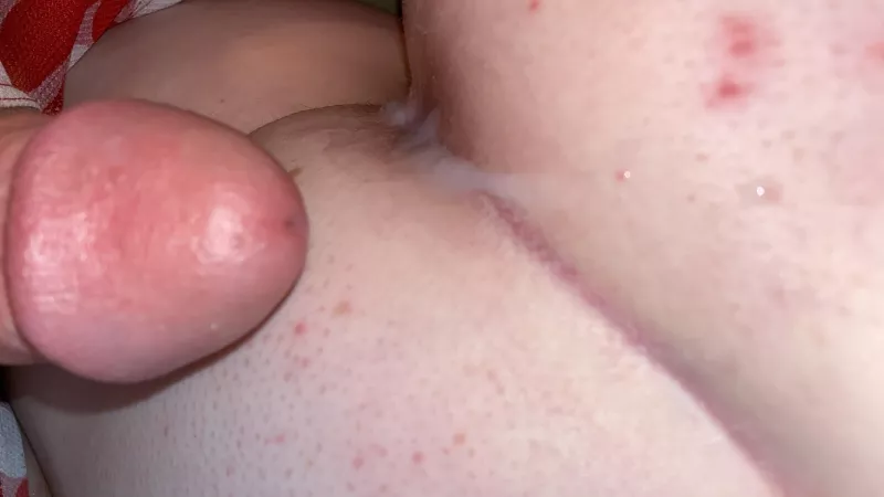 My ass hurts so much painal for the first time by trekink_freeO1lyF4ns