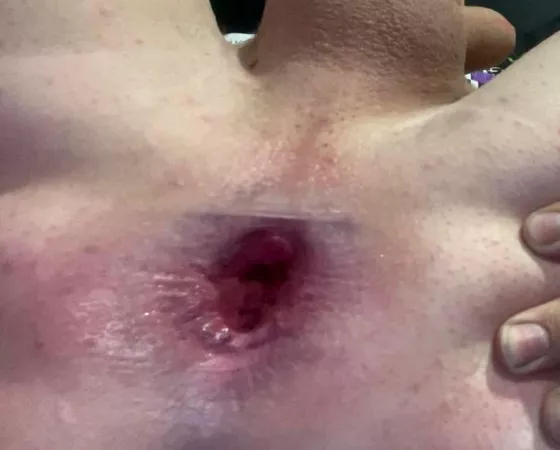 My asshole after a hard fuck by Front_Jump_34