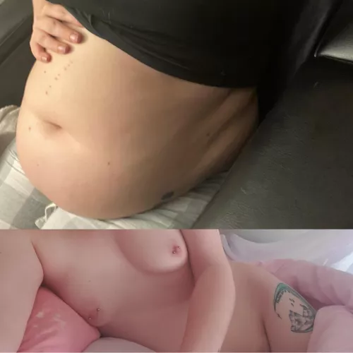 My belly keeps swelling by Apprehensive-Cap8093