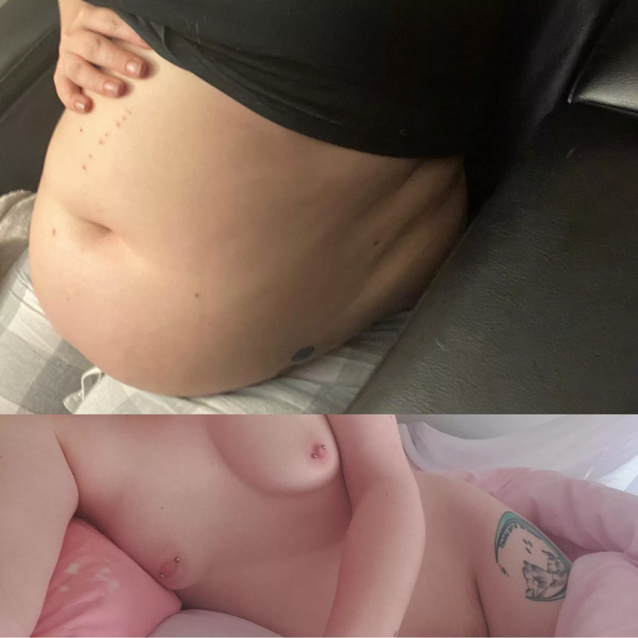 My belly keeps swelling posted by Apprehensive-Cap8093