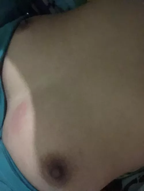 My boob got bitten by an ant by FairyJasmin