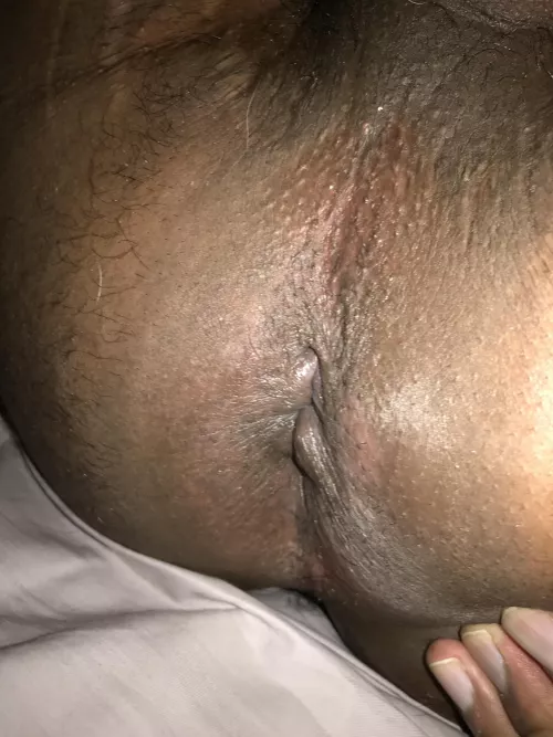 My butthole after having a buttplug in for 3 hours by BeginningBirthday
