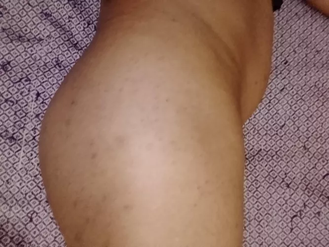 My butts by nursse1981