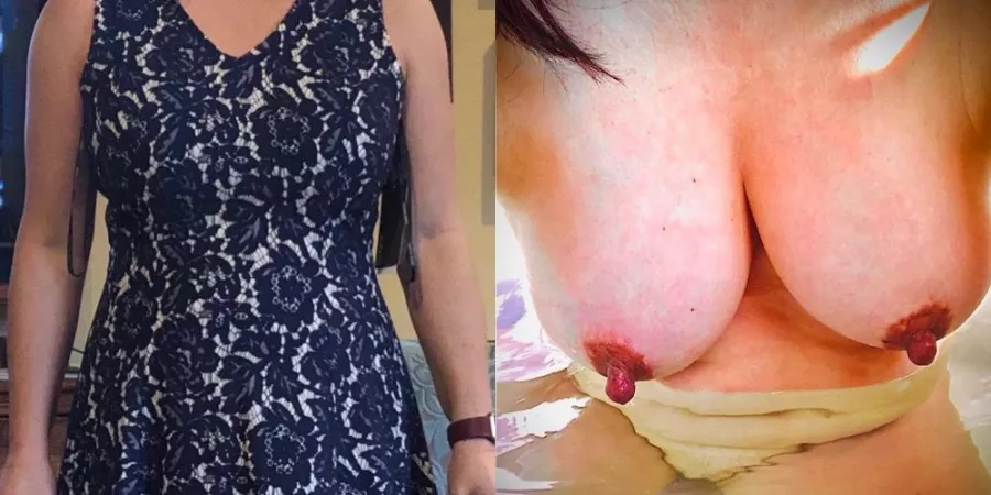 My dress hides them pretty well by Lake6578