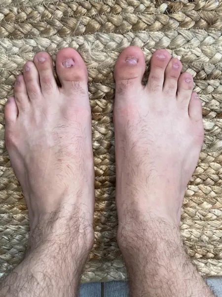 My feet are a little unique, I hope you bros like em🦶 by TJ2065