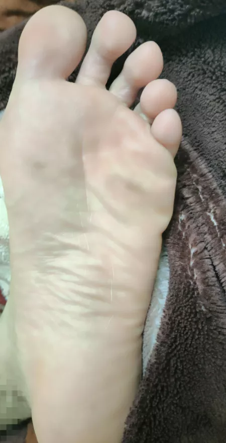 My feet need some care 🤍 by Primary-Mushroom4074