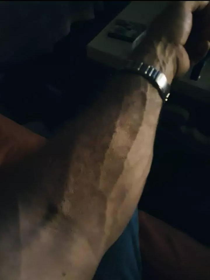 My forearm..Ive got a good grip posted by nt011819