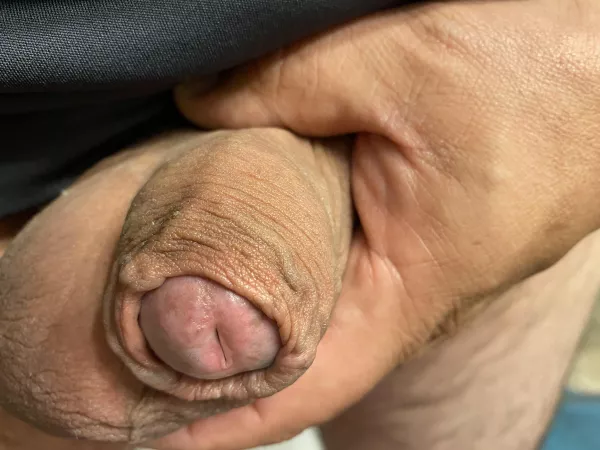 My foreskin and leaky tip. Do you like it? by Fairwaydivots