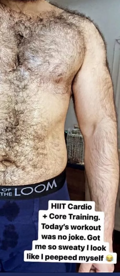 My Hairy Arm by UnderstandingOk3379