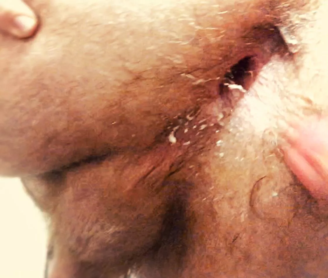 My hole after being used 🤤 fucked myself after with the cum as lube 😘 posted by Sempiternal712