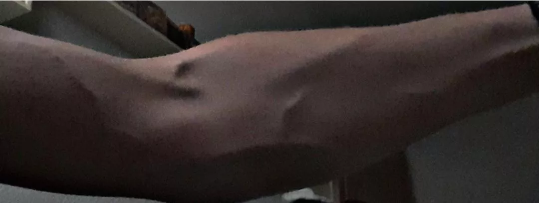 My hot skinny arms 😋 posted by Elegant_Snow_7797