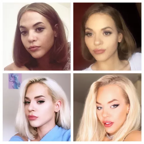 My journey so far ovre the past 3 years(please ignroe my quarantine roots) ; m trying to save for breast implants, a nose job & eyebrow thread lift. If you want to help me fund these, let me know, I want the surgeries as soon as I can and would be su by underwearlardface