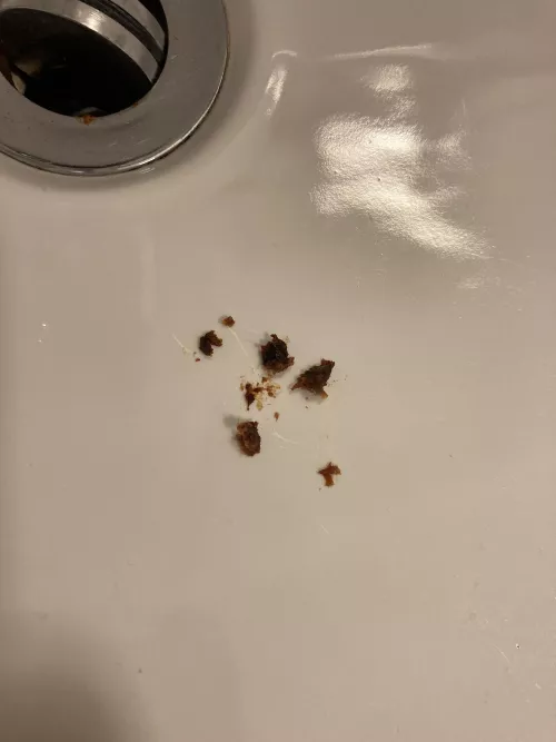 My left ear felt blocked, and this happened by thebiggestleafever