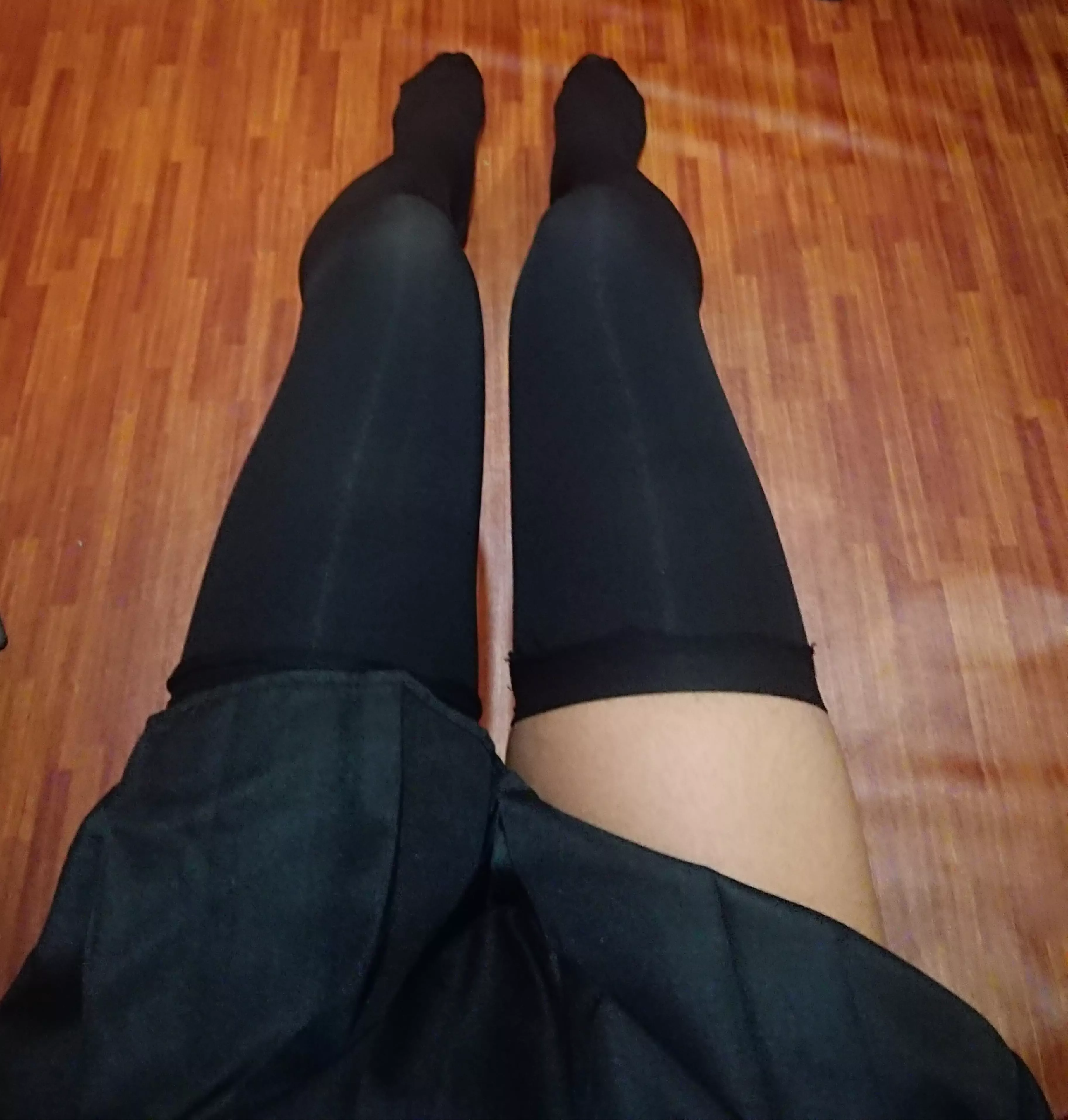 My legs posted by Historical-Salad-308