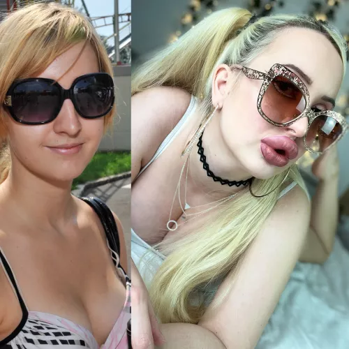 My progress so far. Finally getting breast expanders in February 🥰 by Vivian_Rose1