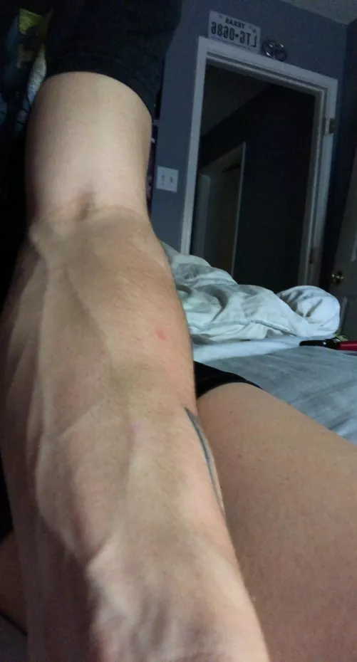 my resting arm by andrewishungg