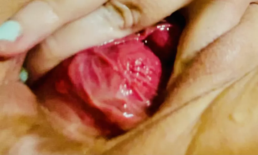 My ruined pussy meat up close! 😍 by omarie33