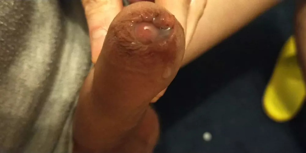 My tight wet head by __dionysian__