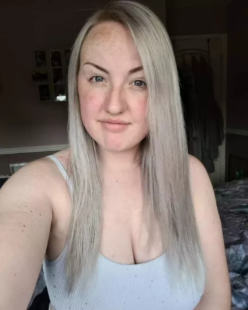 Near impossible to cover up these bad boys by Pyryan