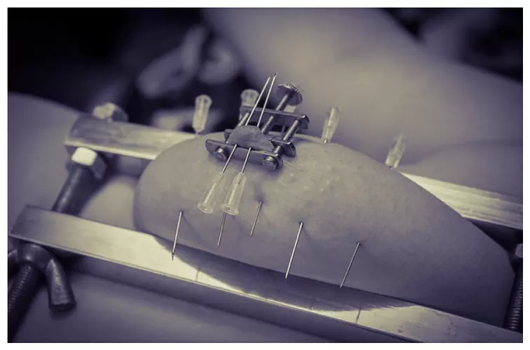 Needle play by sunnymirte