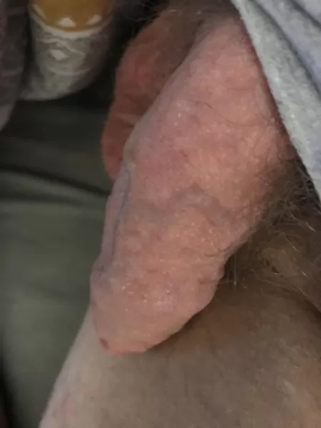 Needs making hard by Oddbin71