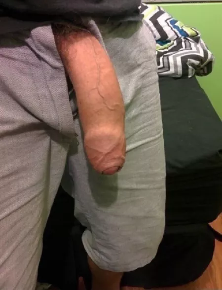 Needs sucking by brianfisher69