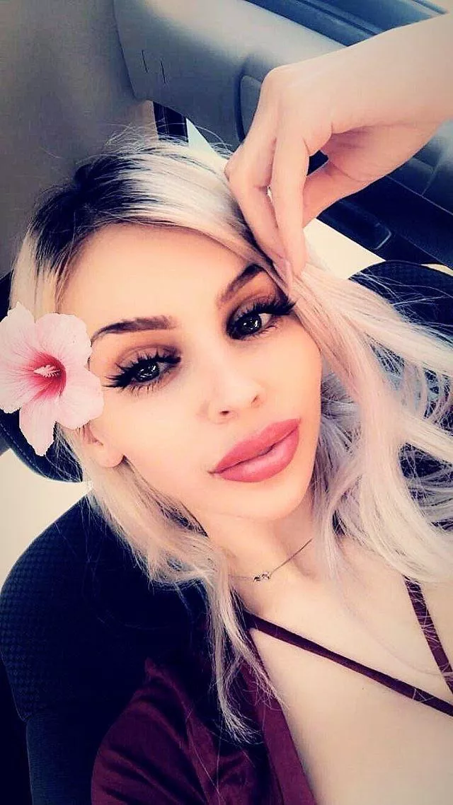 New lips. Yay or nay? posted by Lcfer