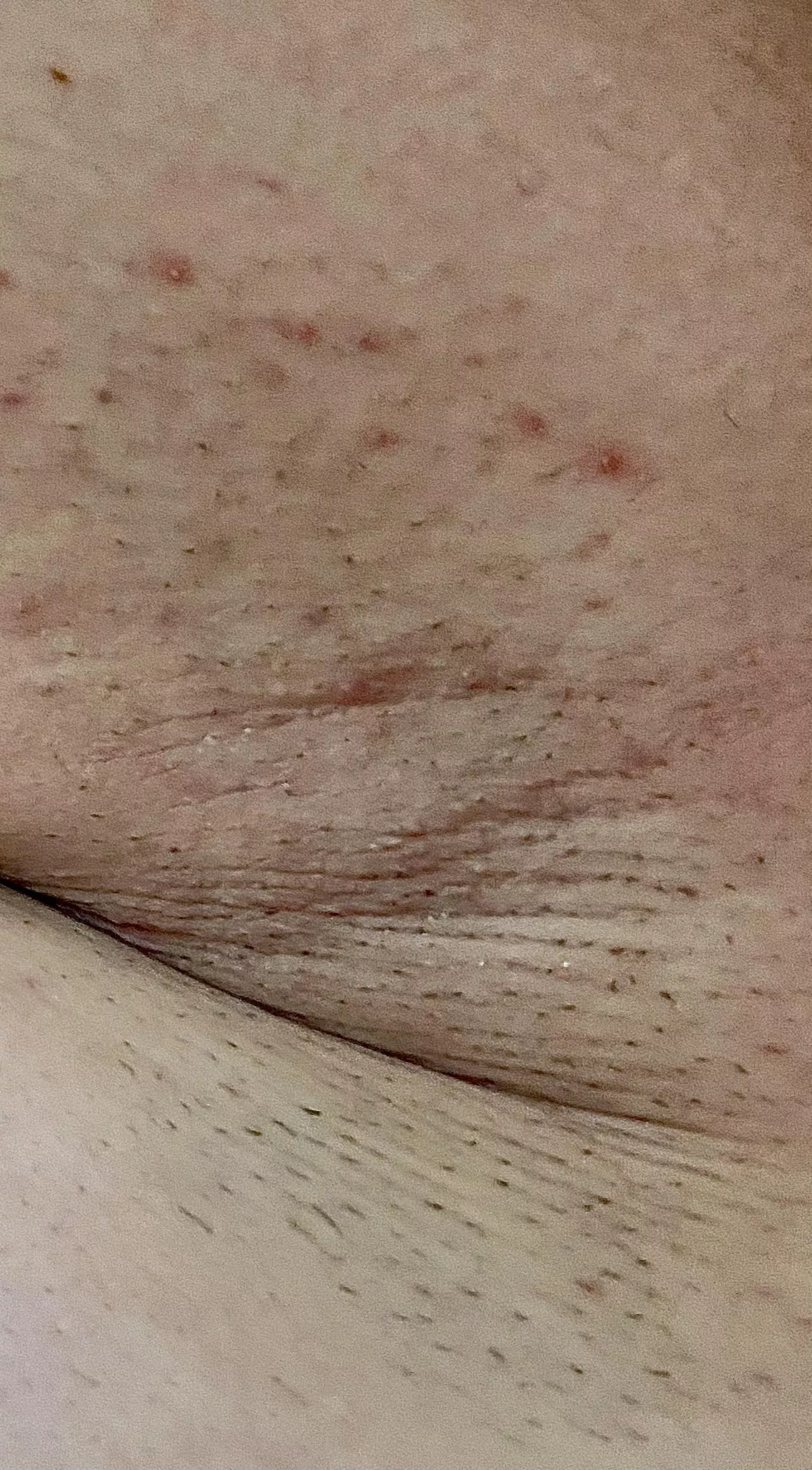 Nice and prickly posted by sunnypits