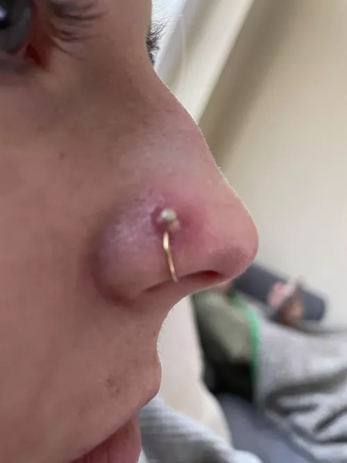Nose ring pimple that needs to be popped. Will update later with video! by adomico