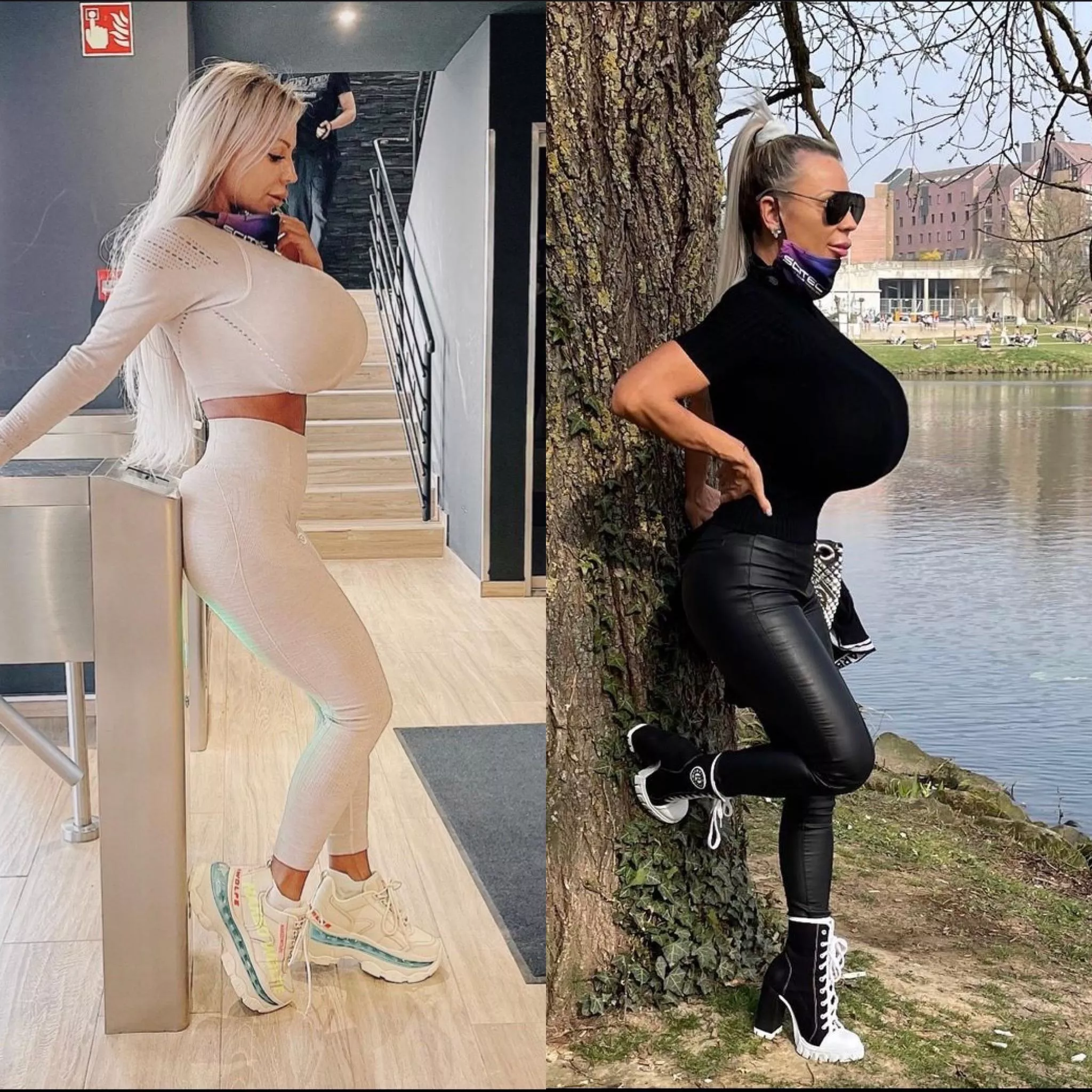 Not natural growth, but Mary Madison just got 3700cc expanders put in. We’ll see how far she goes. posted by woofcatbutterfly