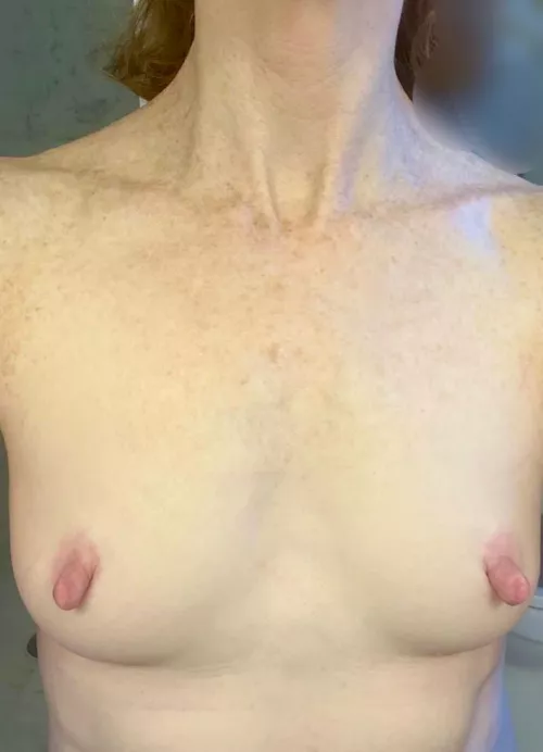 Not the biggest boobs but I love my freckles. by daredone2