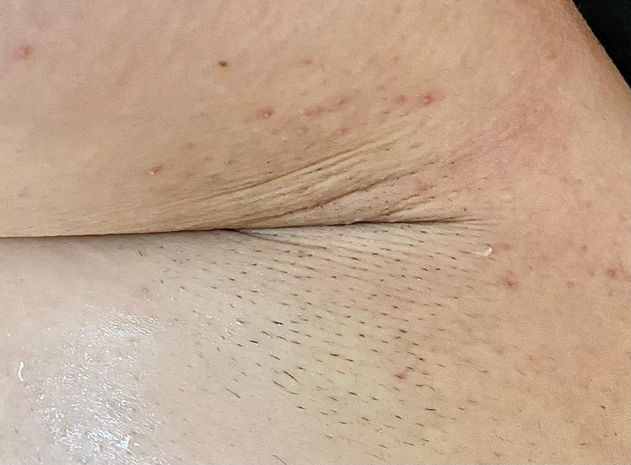 Not using deodorant has really done wonders for my sweating 😓 posted by sunnypits