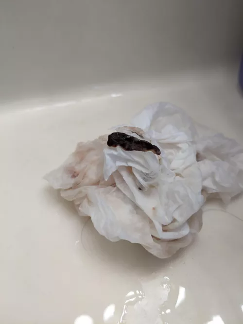 OC: post septoplasty clot. Apparently my sister blows these bad boys out multiple times daily since the surgery. This one included a bit of a broken stint at its core. by lazychefrachel