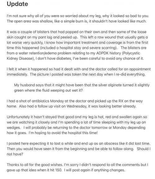 Off to the hospital! My wound is doing much better and the normal swelling is down but the back of my leg around the knee has gotten huge and we don’t know why. I’ll try to post if I can but don’t count on it for a while. (Note posted just to have  by FidsLadi