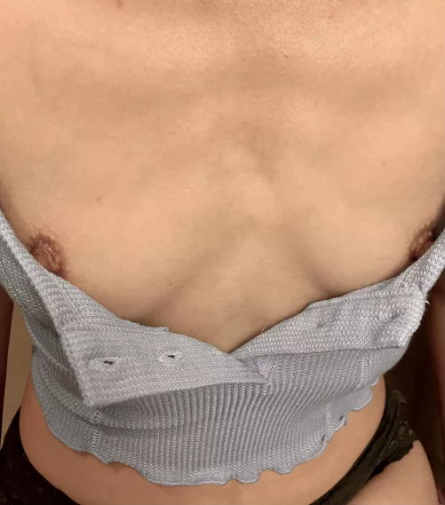 Oh no my button popped ! Did you notice ? by innocent_nikki18