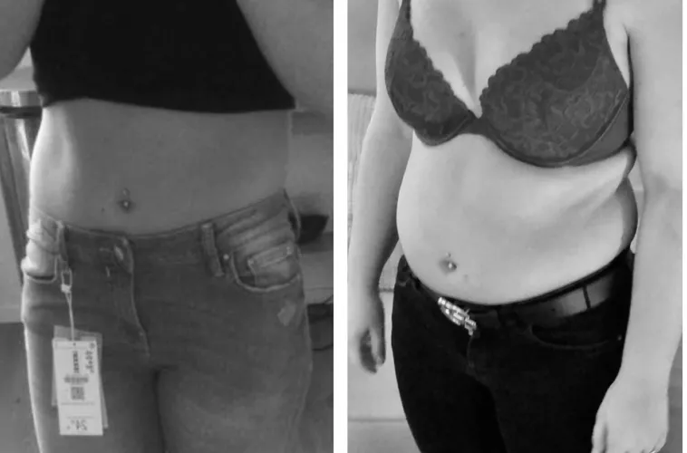 On a scale of 1-10 How noticeable is it? by Intrepid_Escape_108