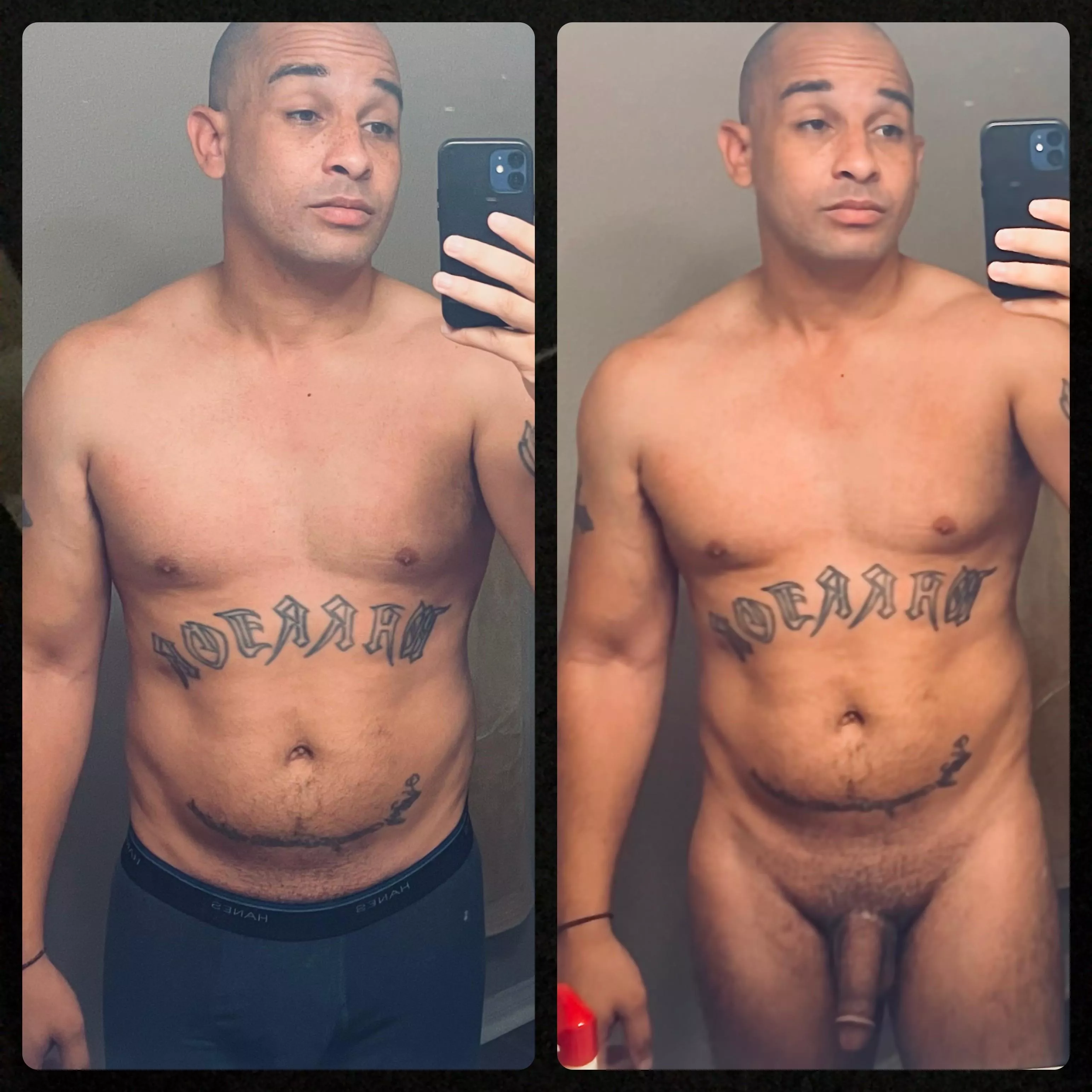 One year and COVIDlbs later… posted by quickerrecovery