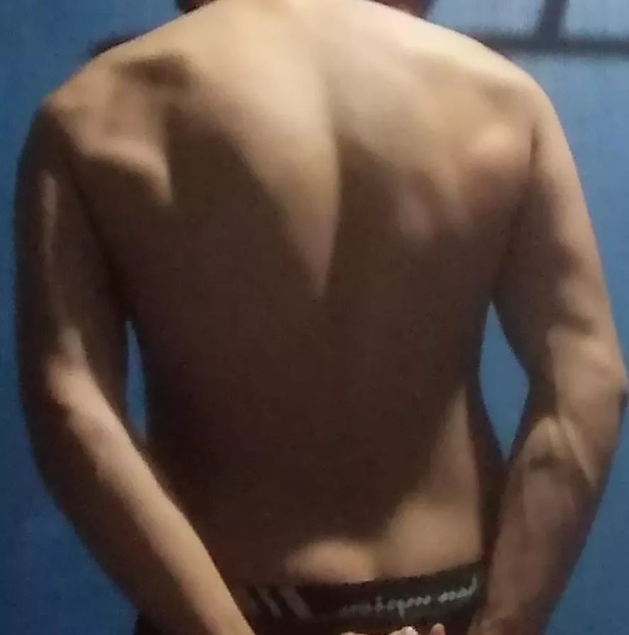 Only one of my forearms is angry posted by Toiletwader