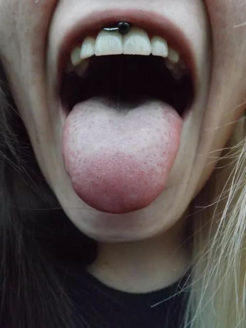 Open wide for you by atoxic420