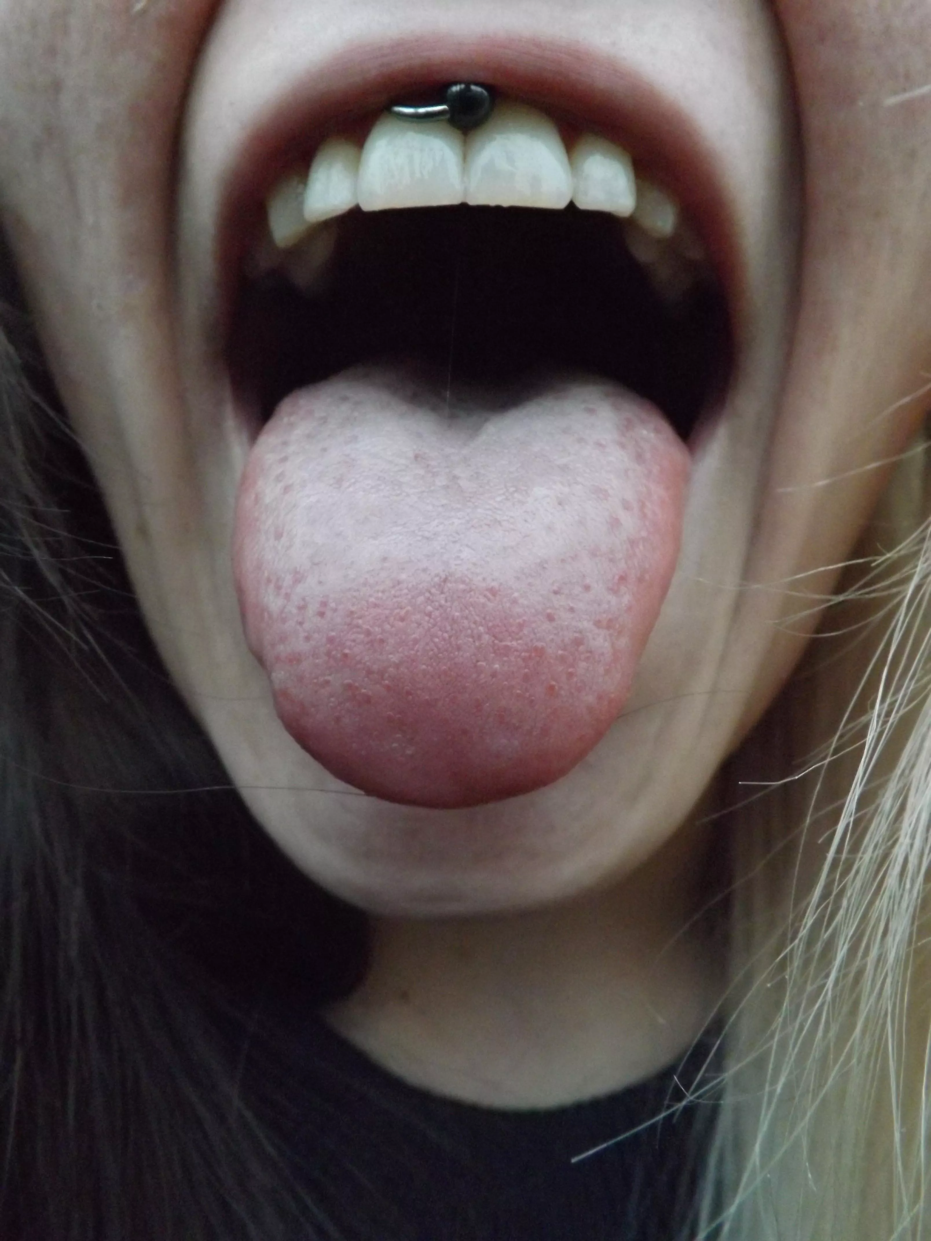 Open wide for you posted by atoxic420