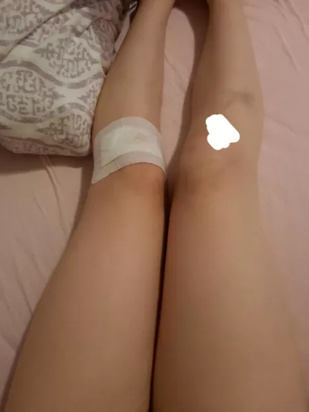 Owie >~< by Horizon-13