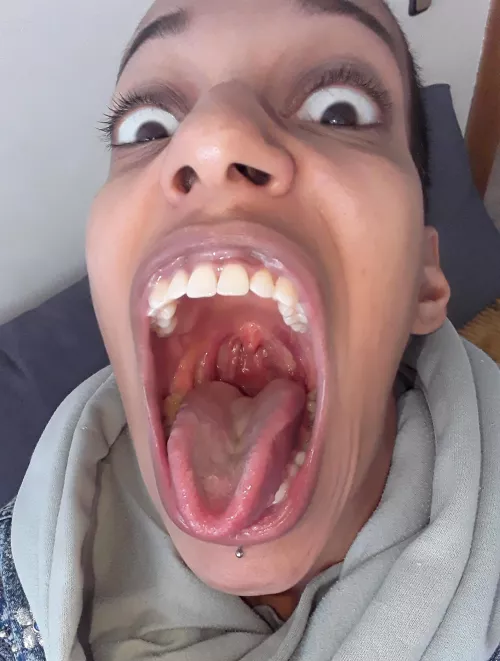 Park is open. Slide on down. by Goldenlace2020