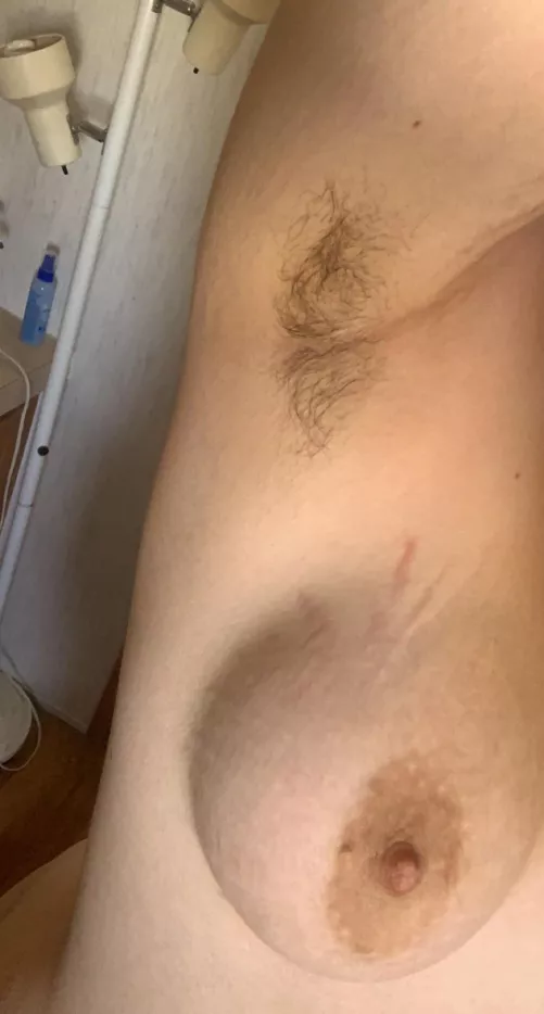 Pits and stretch marks by KinkyMsIvy