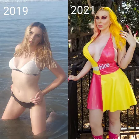 Plastic surgery schedule: fillers monthly, October- BBL, January- MUCH BIGGER implants(I just cant help myself), june 2021-facial reconstruction. by sapphiresummers